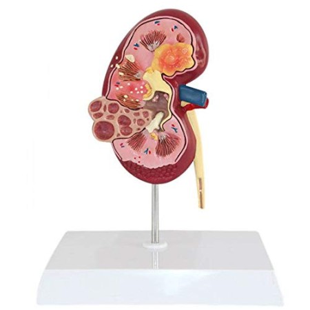 Yuanzhou Urologia Modello Anatomico di Rene Umano 