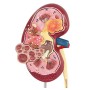Yuanzhou Urologia Modello Anatomico di Rene Umano 