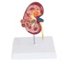 YUANZHOU Modello Anatomico di Rene Umano Modello di Malattia Renale Modello di Rene Urologia